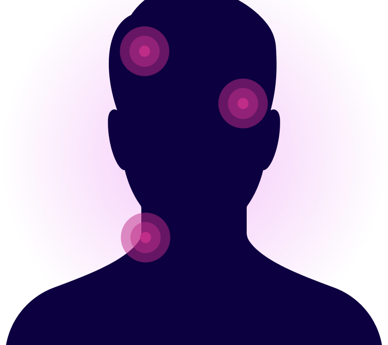 Graphic showing hotspots on the outline of a person's head and neck